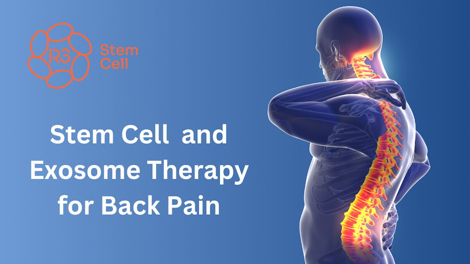 R3 Stem Cell Therapy Back Pain