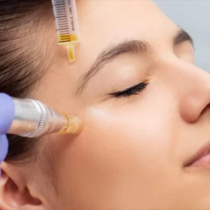 A patient undergoing aesthetic therapy using stem cell methods for rejuvenation.