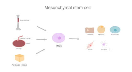 Mesenchymal Stem Cells (MSCs)