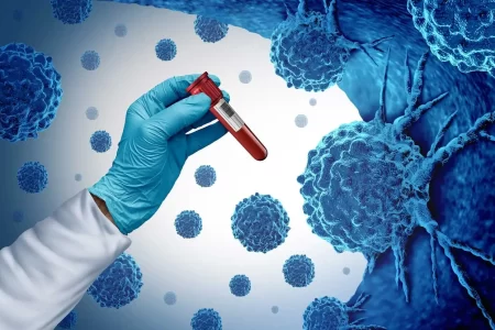 Peripheral Blood Stem Cell Transplantation