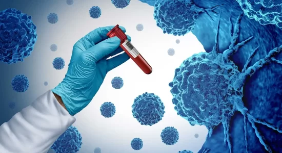 Peripheral Blood Stem Cell Transplantation