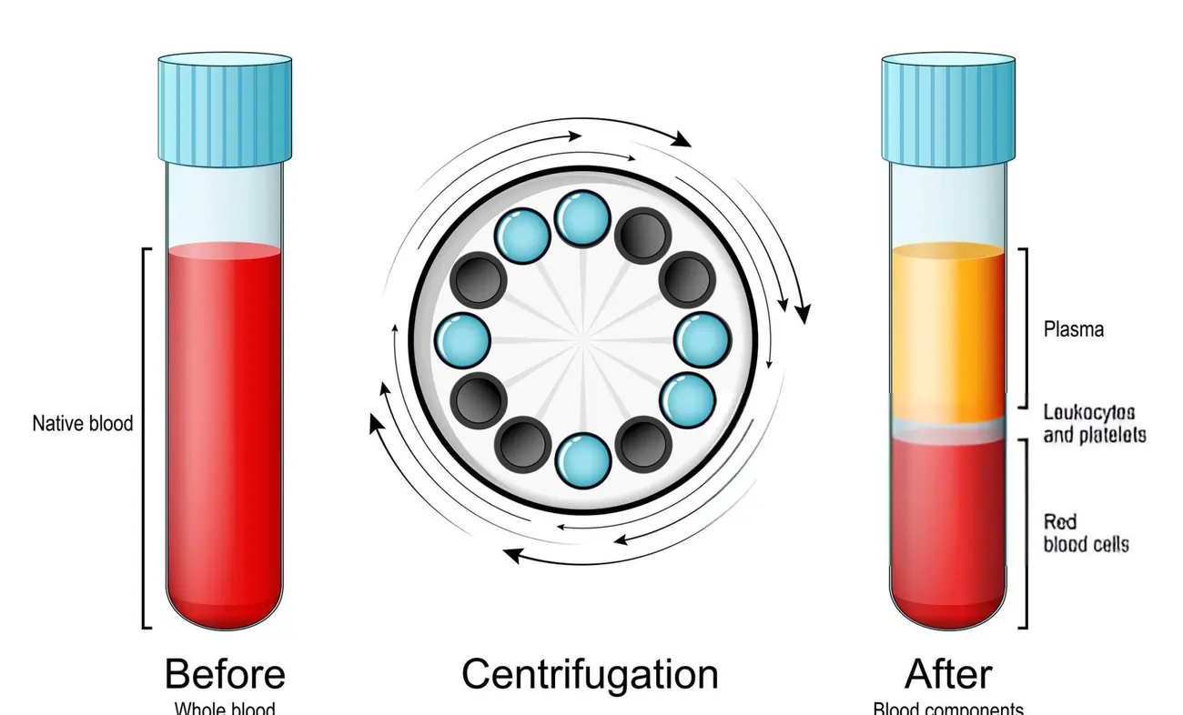 A scientific diagram illustrating the centrifugation process of whole blood to separate it into its components: red blood cells, leukocytes and platelets, and plasma for use in platelet-rich plasma (PRP) therapy.