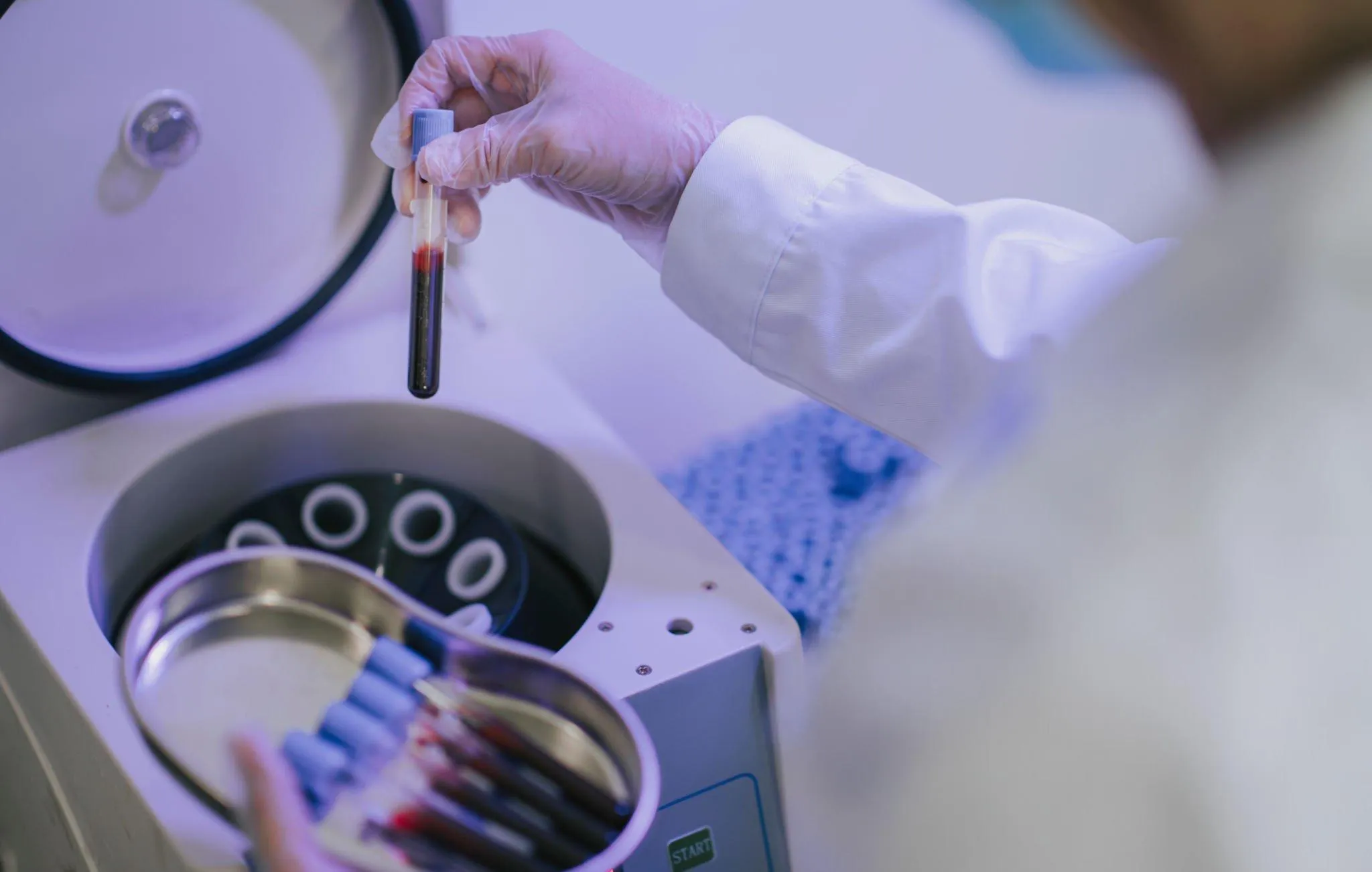 Laboratory technician preparing PRP therapy sample