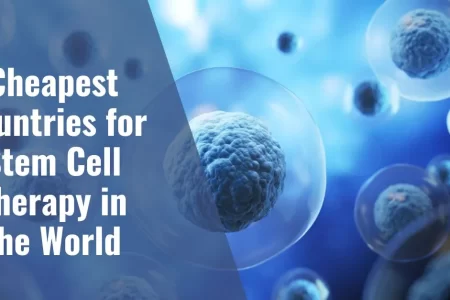 Most Affordable Countries for Stem Cell treatment in the World