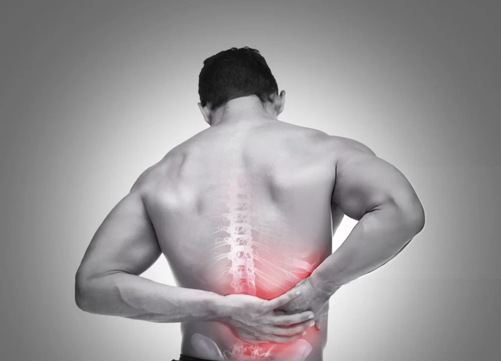 Back Pain Radiating to Ribs