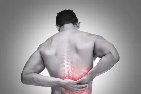 Back Pain Radiating to Ribs