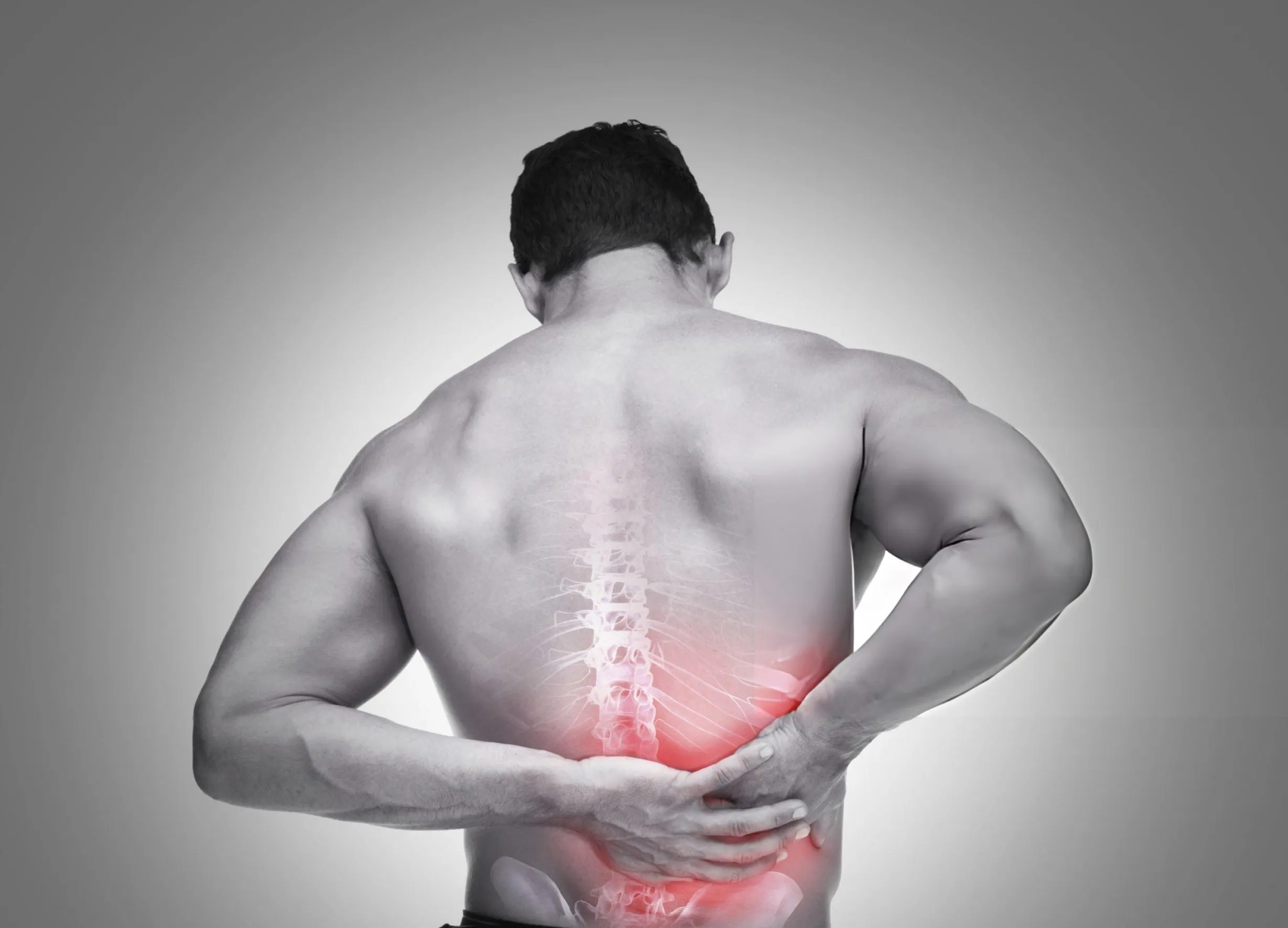 Back Pain Radiating to Ribs