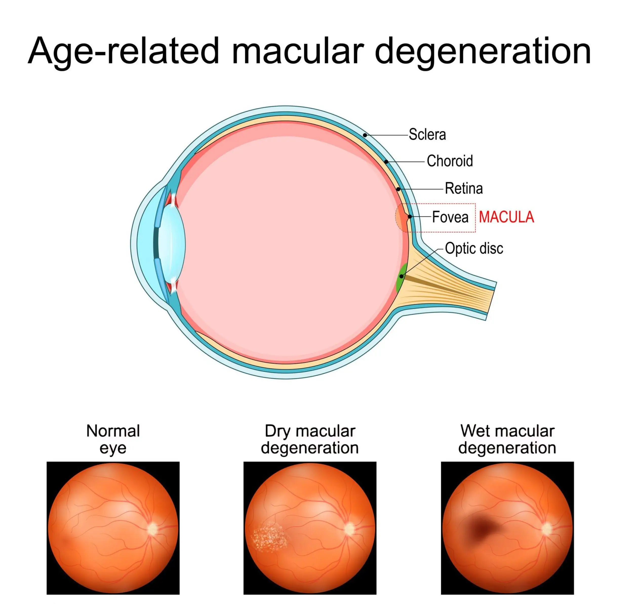macula stem cell transplant